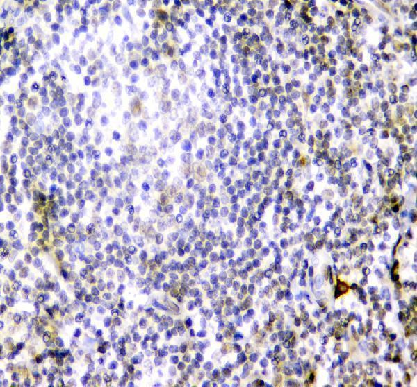 a04872 2 cd84 primary antibodies ihc testing 3