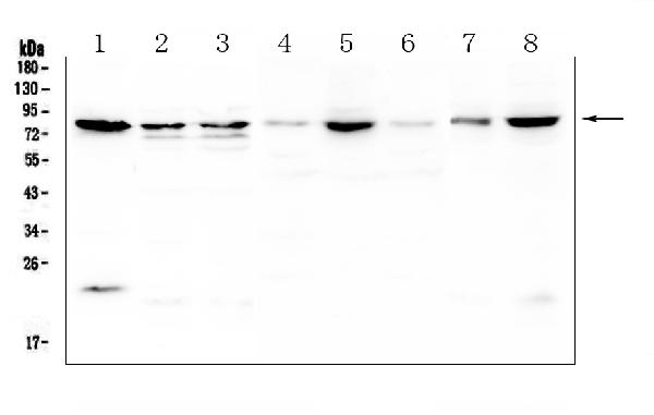 Western blot analysis of POMT2 using anti-POMT2 antibody (A04876-1). Electrophoresis was performed on a 5-20% SDS-PAGE gel at 70V (Stacking gel) / 90V (Resolving gel) for 2-3 hours. The sample well of each lane was loaded with 50ug of sample under reducing conditions. Lane 1: human PC-3 whole cell lysates, Lane 2: human Caco-2 whole cell lysates, Lane 3: human HepG2 whole cell lysates, Lane 4: rat lung tissue lysates, Lane 5: rat testis tissue lysates, Lane 6: rat spleen tissue lysates, Lane 7: mouse lung tissue lysates, Lane 8: mouse testis tissue lysates. After Electrophoresis, proteins were transferred to a Nitrocellulose membrane at 150mA for 50-90 minutes. Blocked the membrane with 5% Non-fat Milk/ TBS for 1.5 hour at RT. The membrane was incubated with rabbit anti-POMT2 antigen affinity purified polyclonal antibody (Catalog # A04876-1) at 0.5 μg/mL overnight at 4°C, then washed with TBS-0.1%Tween 3 times with 5 minutes each and probed with a goat anti-rabbit IgG-HRP secondary antibody at a dilution of 1:10000 for 1.5 hour at RT. The signal is developed using an Enhanced Chemiluminescent detection (ECL) kit (Catalog # EK1002) with Tanon 5200 system. A specific band was detected for POMT2 at approximately 84KD. The expected band size for POMT2 is at 84KD.