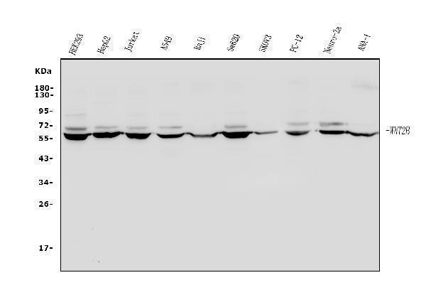  Western blot analysis of Wnt2b using anti-Wnt2b antibody (A04879-1)