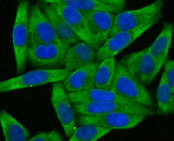 a04879 wnt2b primary antiboties icc testing 2