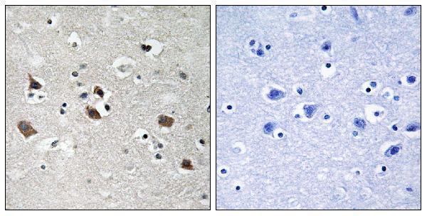 Immunohistochemistry analysis of paraffin-embedded human brain, using SLP-76 (Phospho-Tyr128) Antibody