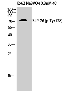 Western Blot analysis of K562 cells using Phospho-SLP-76 (Y128) Polyclonal Antibody