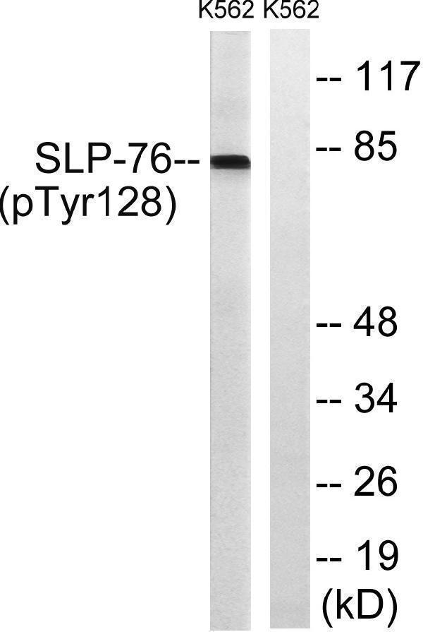 Western blot analysis of lysates from K562 cells treated with Na3VO4 0