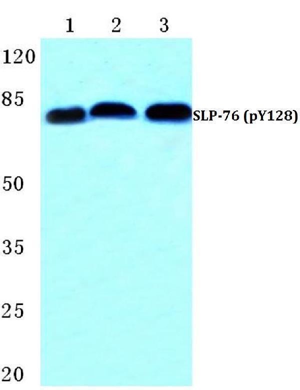 a04880y128 lcp2 primary antiboties wb testing 1