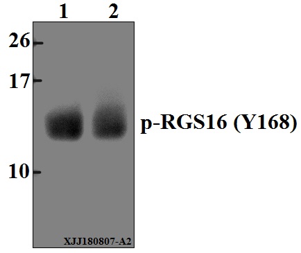 Western blot (WB) analysis of p-RGS16 (Y168) pAb at 1:500 dilution
Lane1:The Eye tissue lysate of Mouse(40µg)
Lane2:The Eye tissue lysate of Rat(40µg)