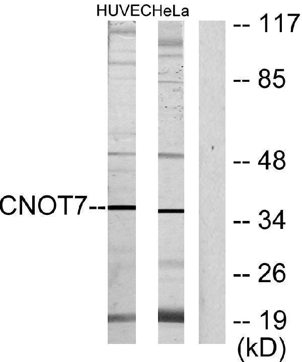 Western blot analysis of lysates from HeLa and HUVEC cells, using CNOT7 Antibody