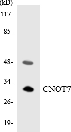 Western blot analysis of the lysates from HUVECcells using CNOT7 antibody