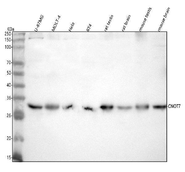  Western blot analysis of CNOT7 using anti-CNOT7 antibody (A04884-3)