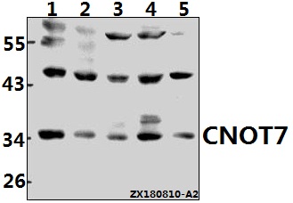 Western blot (WB) analysis of CNOT7 (N19) Antibody at 1:1000 dilution
Lane1:Myla2059 whole cell lysate(40ug)
Lane2:HEK293T whole cell lysate(40ug)
Lane3:Hela whole cell lysate(40ug)
Lane4:PC12 whole cell lysate(40ug)
Lane5:3T3-L1 whole cell lysate(40ug)