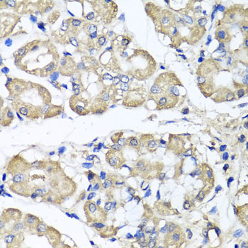 Immunohistochemistry of paraffin-embedded human stomach using BCS1L antibody  at dilution of 1:100 