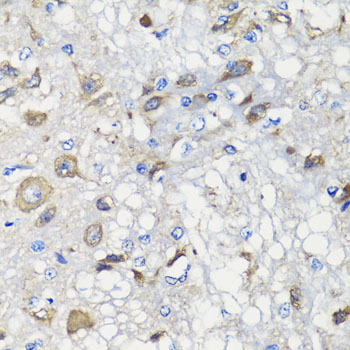 Immunohistochemistry of paraffin-embedded rat brain using BCS1L antibody  at dilution of 1:100 