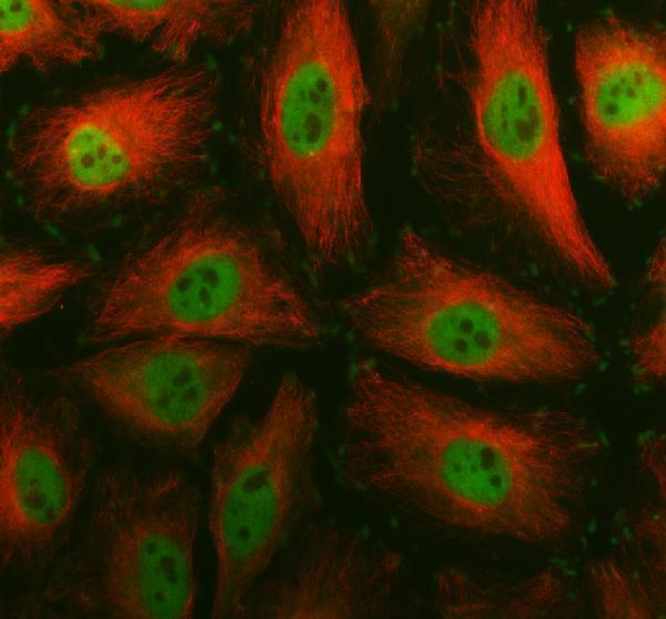 IF analysis of SMC4 using anti-SMC4 antibody (A04887-1) and anti-Tubulin Alpha antibody (M03989-3)