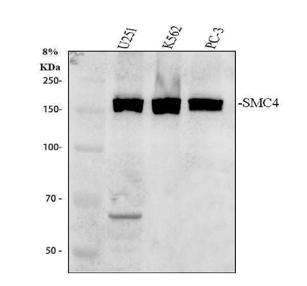Western blot analysis of SMC4 using anti-SMC4 antibody (A04887-1)