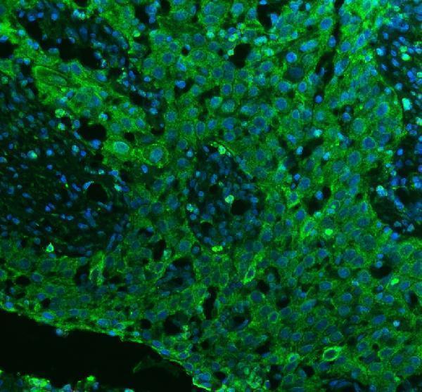 a04890 2 rab27b primary antibodies if testing 5