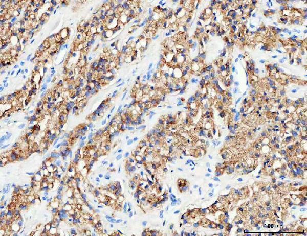  IHC analysis of RAB27B using anti-RAB27B antibody (A04890-2)
