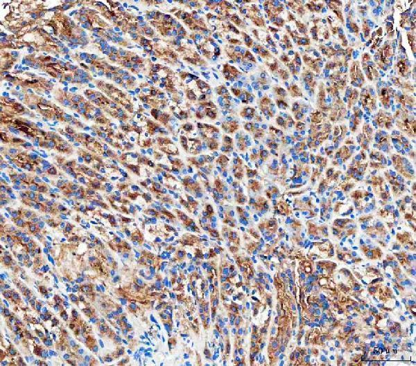  IHC analysis of RAB27B using anti-RAB27B antibody (A04890-2)
