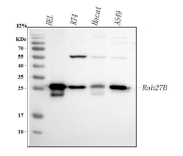 Western blot analysis of RAB27B using anti-RAB27B antibody (A04890-2)
