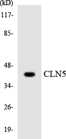 Western blot analysis of the lysates from COLO205 cells using CLN5 antibody