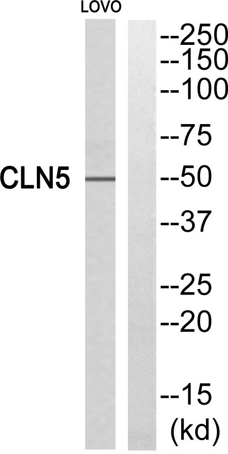 Western blot analysis of CLN5 Antibody