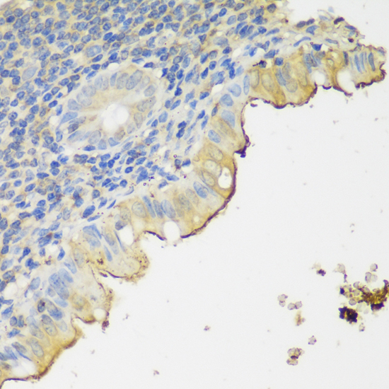 Immunohistochemistry of paraffin-embedded human appendix using CLN5 antibody  at dilution of 1:150 