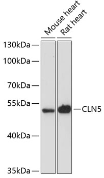 Western blot (WB) analysis of CLN5 pAb at 1:500 dilution
Lane1:PMVEC whole cell lysate(40ug)
Lane2:AML-12 whole cell lysate(40ug)
Lane3:L02 whole cell lysate(40ug)
Lane4:A549 whole cell lysate(40ug)
