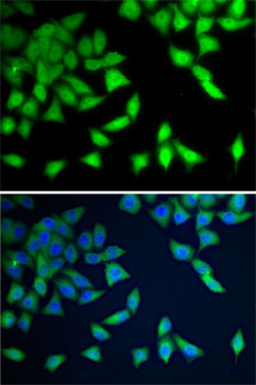 Immunofluorescence analysis of A-549 cells using WDR77 antibody 