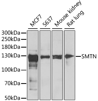 a04895 1 smtn primary antiboties wb testing 1