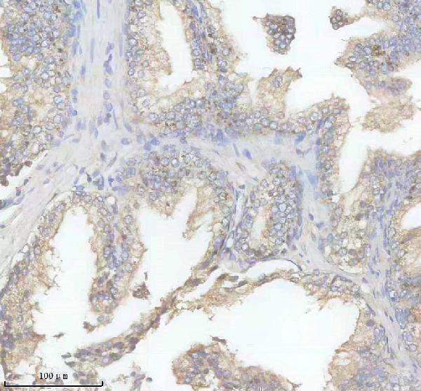 a04895 2 fuca primary antibodies ihc testing 1