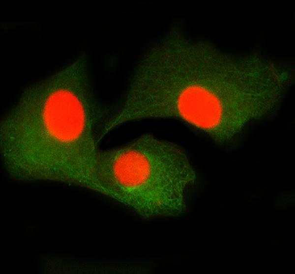 a04895 2 smtn primary antibodies if testing 2