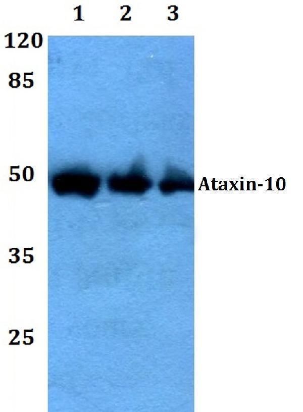 Western blot (WB) analysis of Ataxin-10 polyclonal antibody at 1:500 dilution
Lane1:Hela whole cell lysate
Lane2:sp2/0 whole cell lysate
Lane3:H9C2 whole cell lysate
