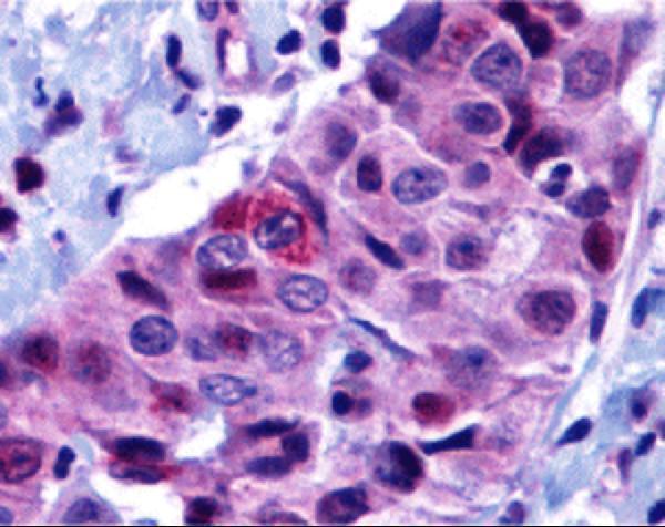 a04899 1 bbc3 primary antibodies ihc testing 4