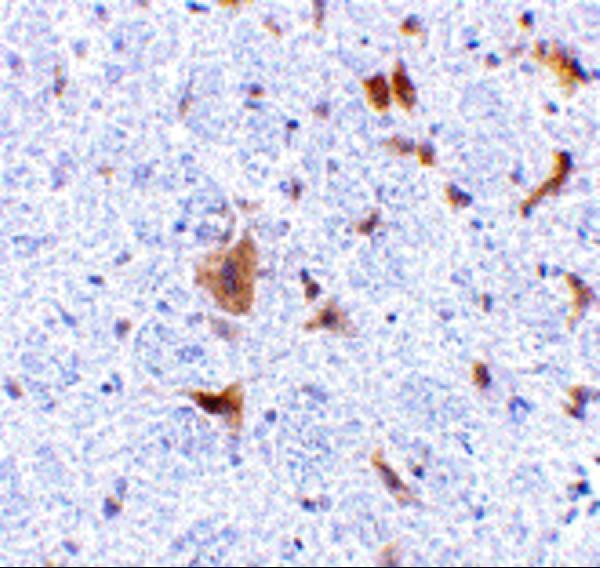 Immunohistochemistry of FAIM2 in mouse brain tissue with FAIM2 antibody at 5 μg/mL