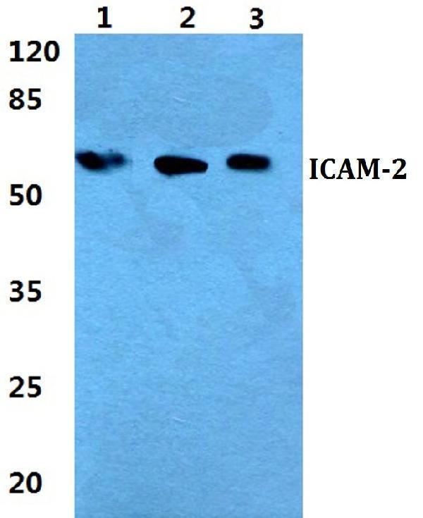 a04901 icam2 primary antiboties wb testing 1