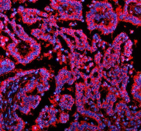 a04902 1 nsdhl primary antibodies if testing 1