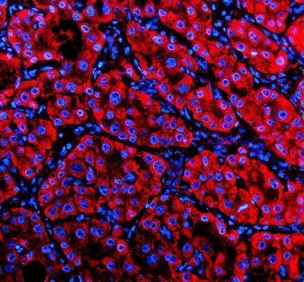 a04902 1 nsdhl primary antibodies if testing 2