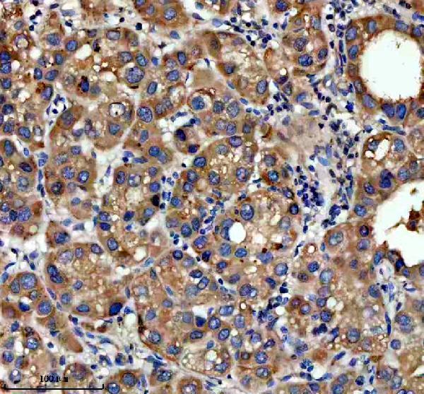 IHC analysis of NSDHL using anti-NSDHL antibody (A04902-1)