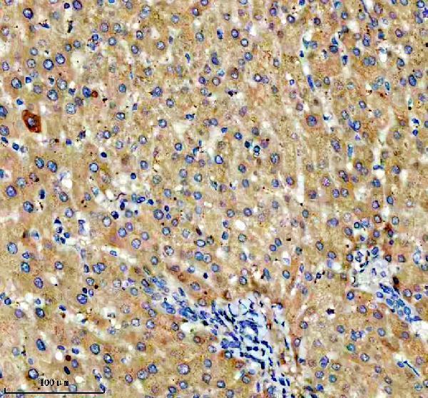 IHC analysis of NSDHL using anti-NSDHL antibody (A04902-1)