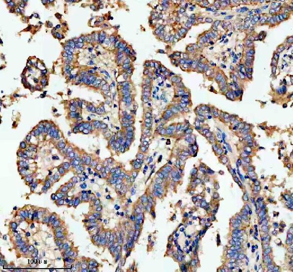a04902 1 nsdhl primary antibodies ihc testing 3