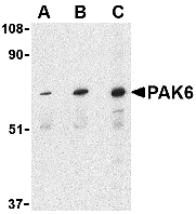 a04903 pak6 primary antibodies wb testing 1