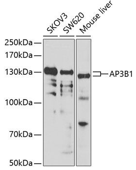 a04904 ap3b1 primary antiboties wb testing 1