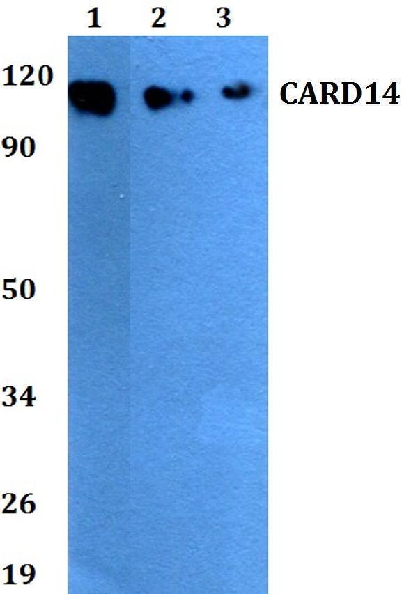a04906 1 card14 primary antiboties wb testing 1