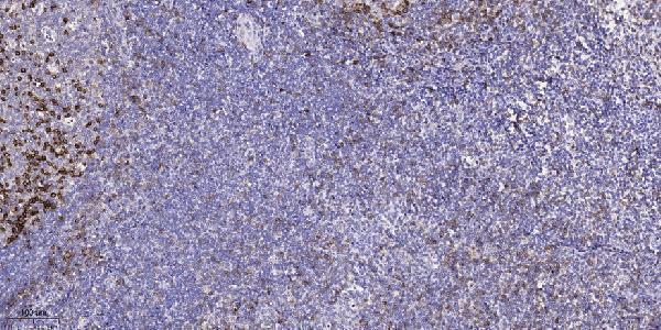 a04906 2 card14 primary antibodies ihc testing 2