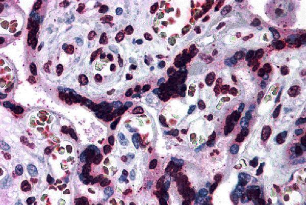 Immunohistochemistry of CARMA2 in human placenta tissue with CARMA2 antibody at 5 μg/mL