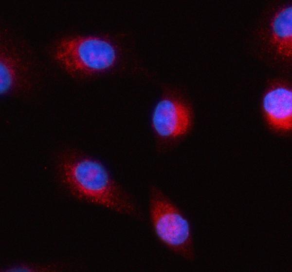 a04908 2 herpud1 primary antibodies if testing 14