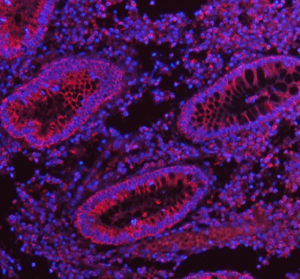 a04908 2 herpud1 primary antibodies if testing 15