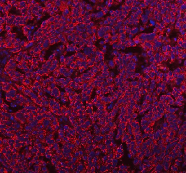 a04908 2 herpud1 primary antibodies if testing 16