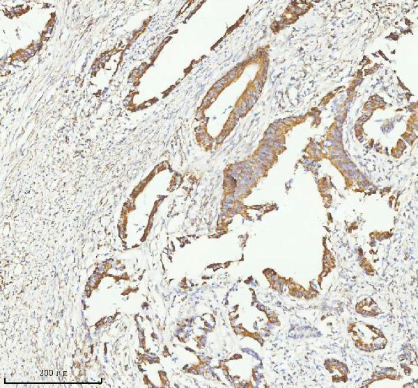 a04908 2 herpud1 primary antibodies ihc testing 10