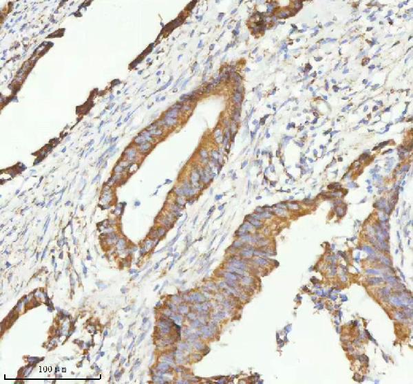 a04908 2 herpud1 primary antibodies ihc testing 11