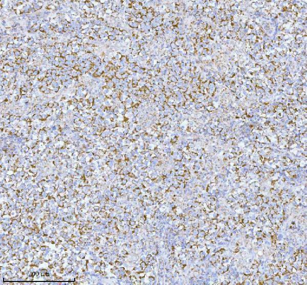 a04908 2 herpud1 primary antibodies ihc testing 12