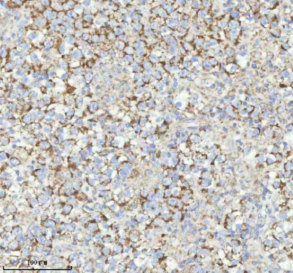 a04908 2 herpud1 primary antibodies ihc testing 13